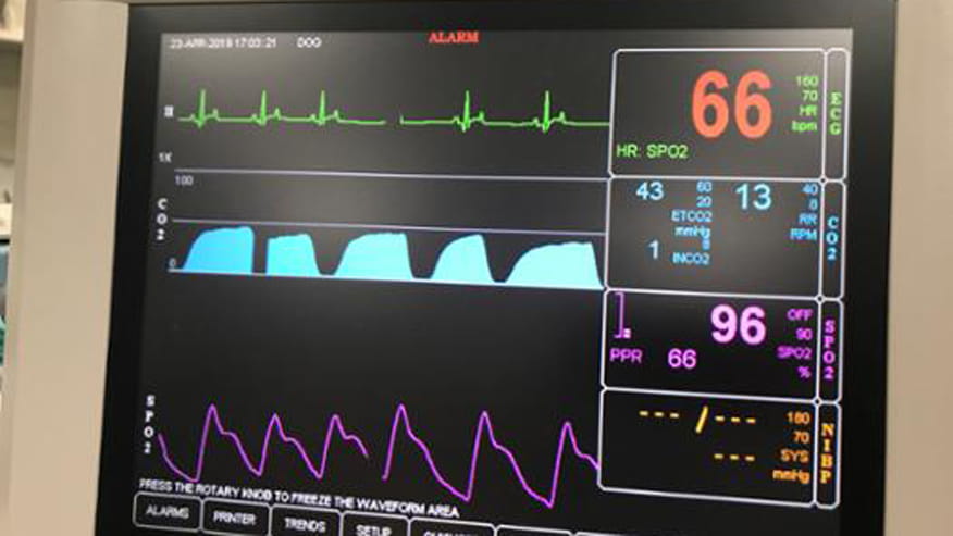 876x493 encina sevoflurane anesthesia